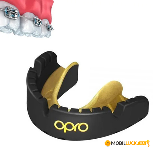  Opro Gold Braces - (37362003)