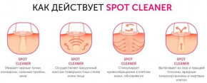     Spot Cleaner, Pore Cleaner      (RV1251) Trends 4