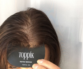  Toppik Hairline 5