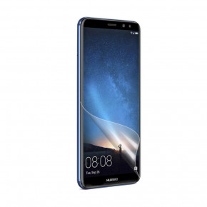    MK Huawei Mate 10 Lite